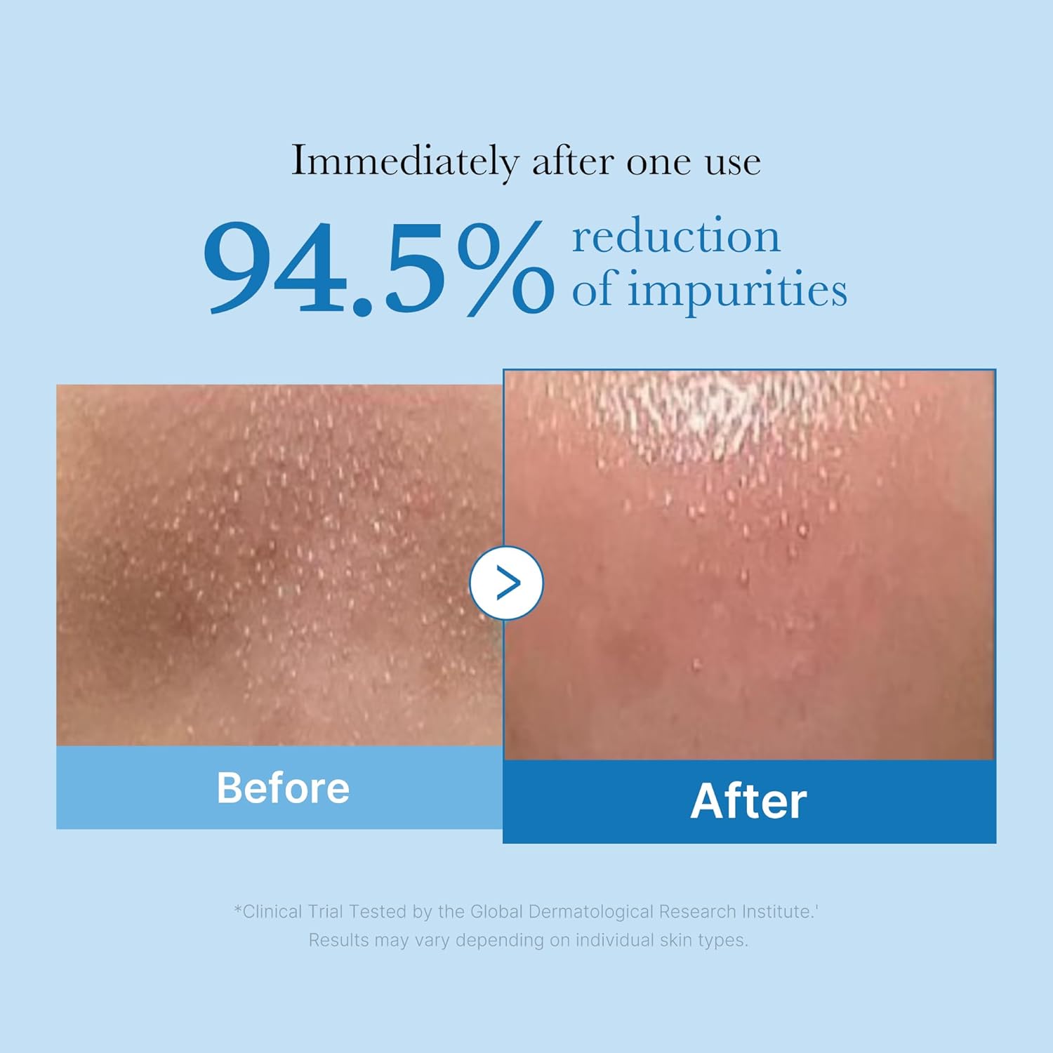Medicube zero pore blackhead cleansing oil
