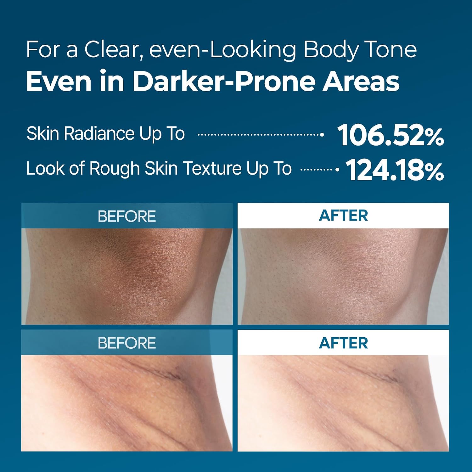Dr.Melaxin Peel Shot Exfoliante TX-Spray 200 ml - 99 % de ácido tranexámico y niacinamida.