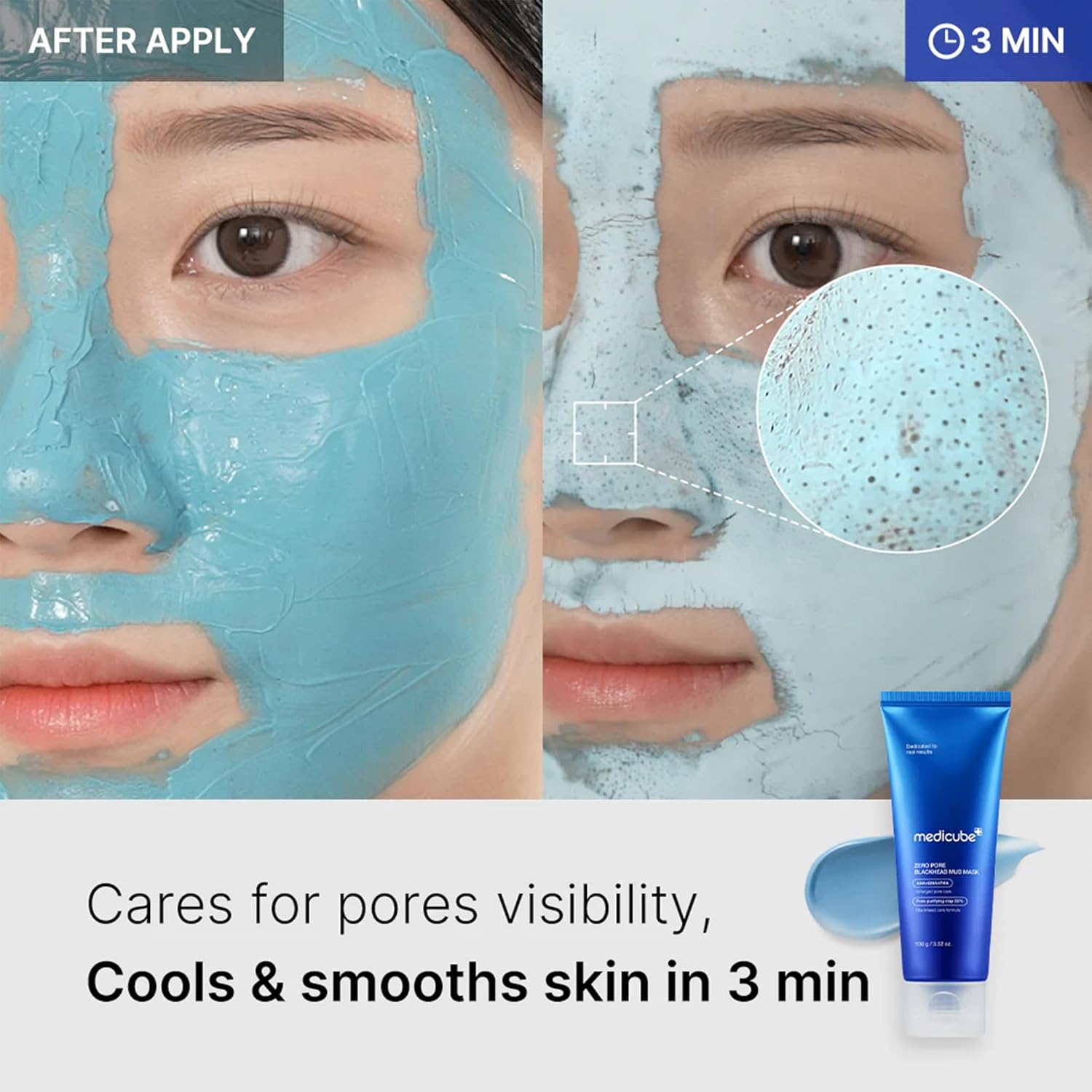 Medicube Máscara facial de barro de puntos negros Zero Pore