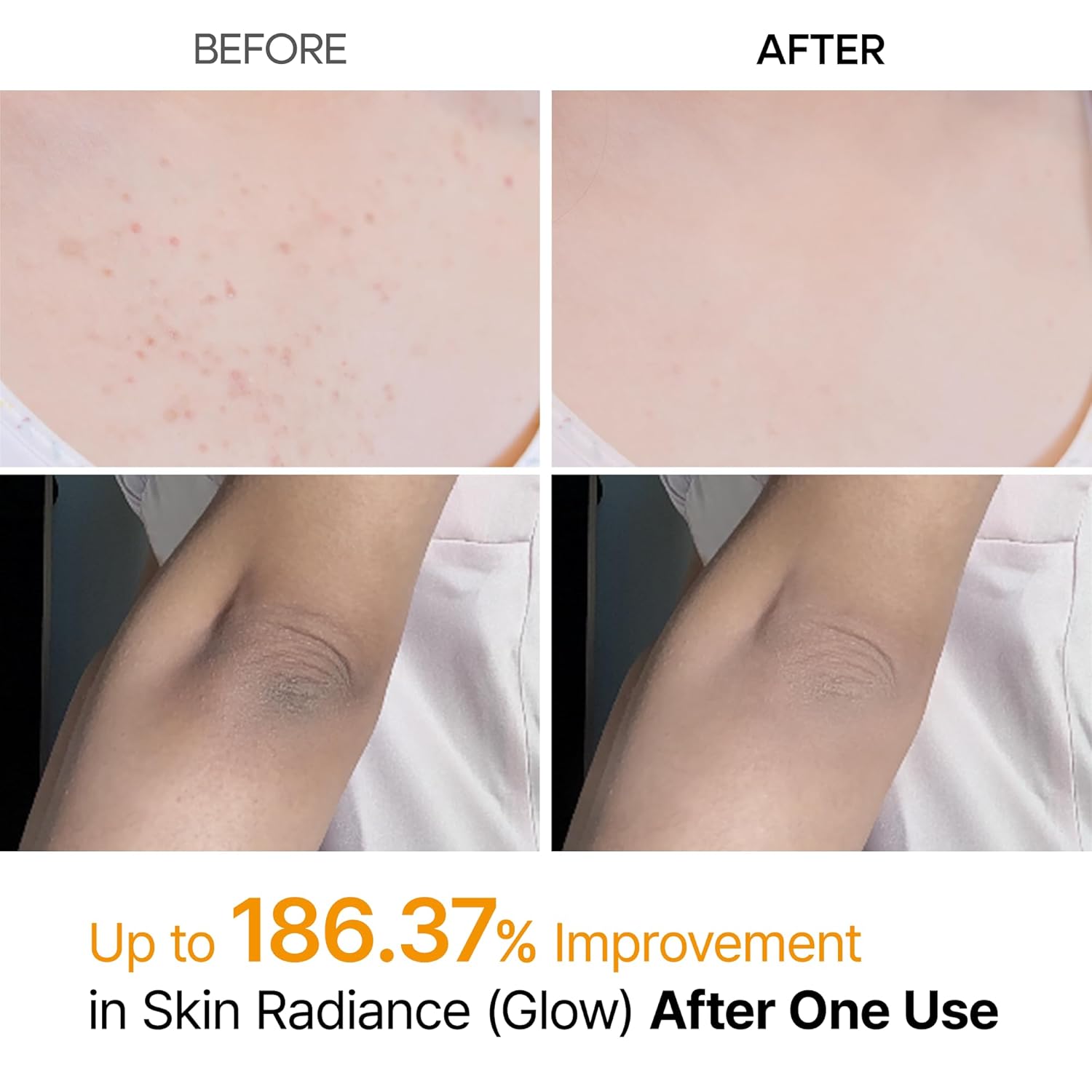 Dr.Melaxin Peel Shot Exfoliante Corporal con Ácido Kójico y Cúrcuma en Spray 200 ml