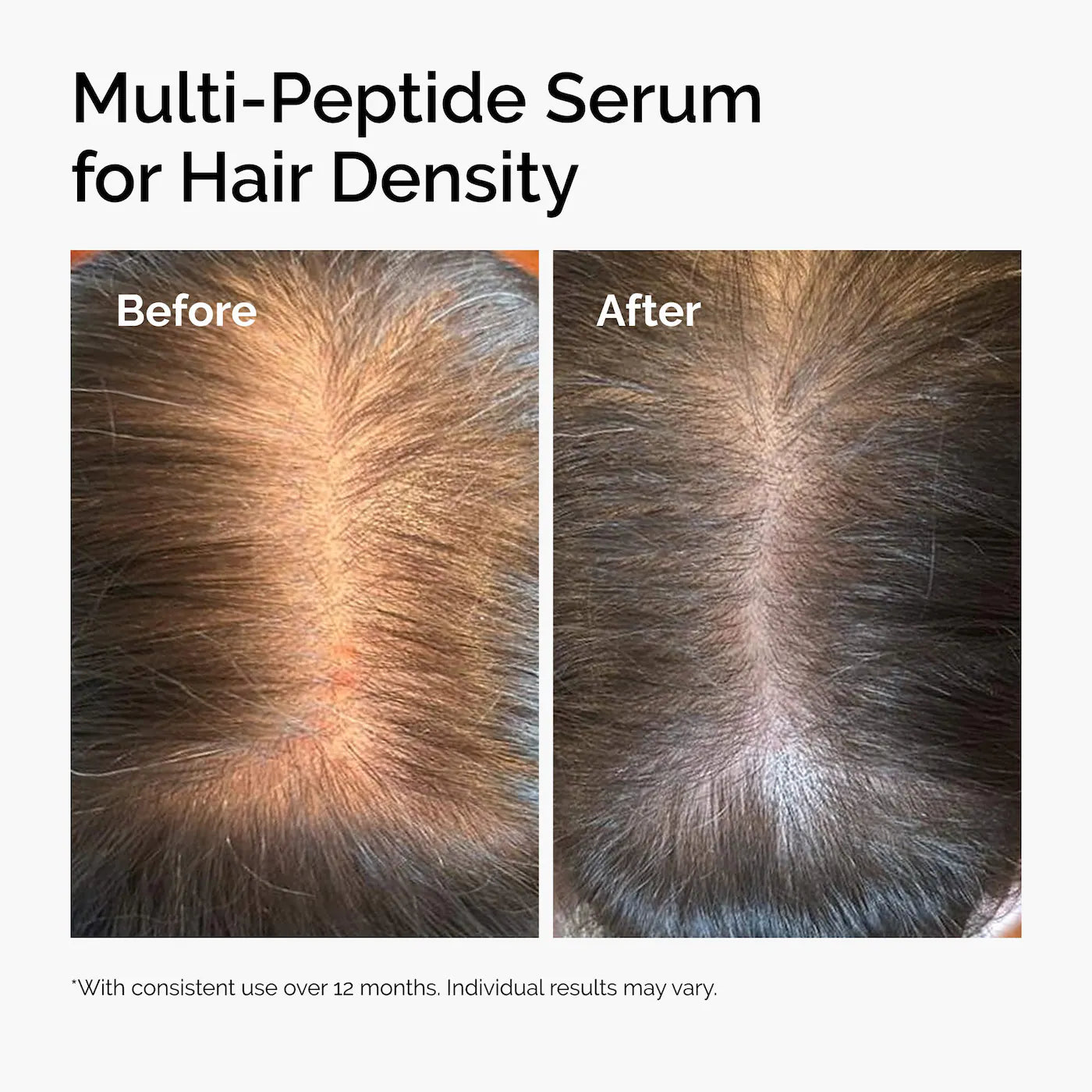 The Ordinary  Multi-Peptide Serum for Hair Density for Thicker, Fuller Looking Hair
