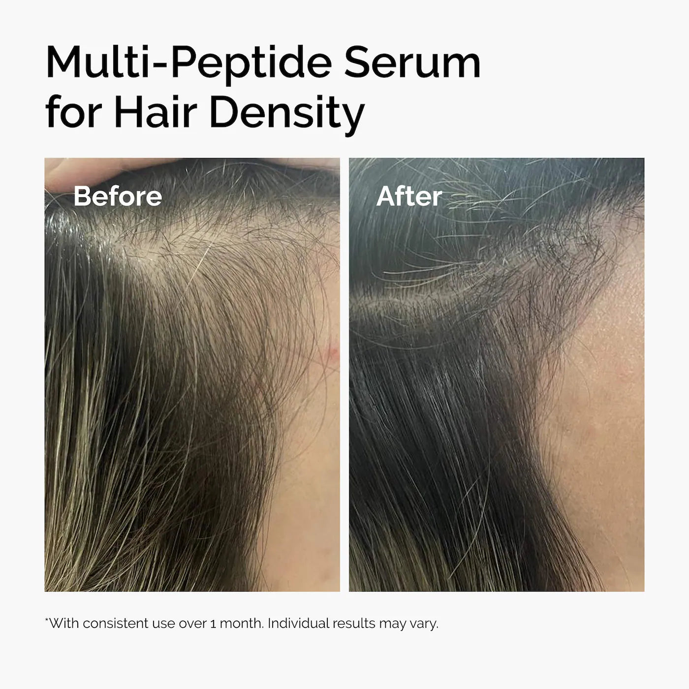 The Ordinary  Multi-Peptide Serum for Hair Density for Thicker, Fuller Looking Hair