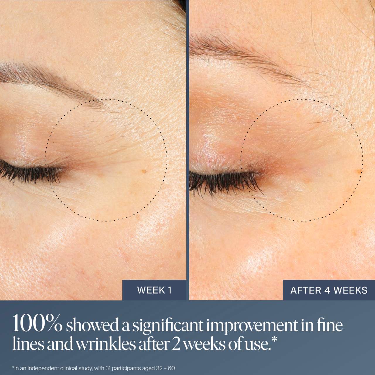 Summer Fridays  Jet Lag Overnight Eye Serum for Fine Lines & Wrinkles with Gentle Retinol Blend