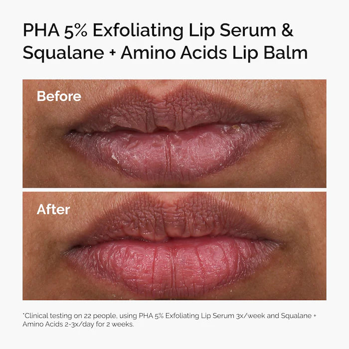 The Ordinary  PHA 5% Exfoliating Lip Serum