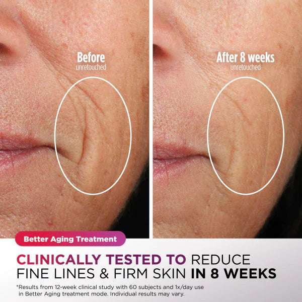 Shark Beauty Under-Eye Cooling + LED Anti-Aging Red Light & Skin Clearing Mask